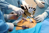 Усольские хирурги успешно применяют щадящие методы оперирования