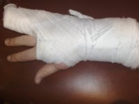 В детском саду Усть-Кута ребенок из-за недосмотра воспитателя сломал палец, прищемив его дверью
